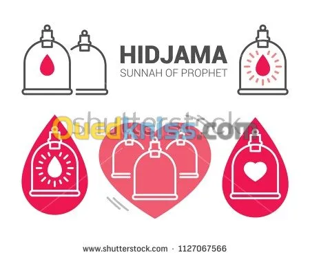 Hijama a Domicile 