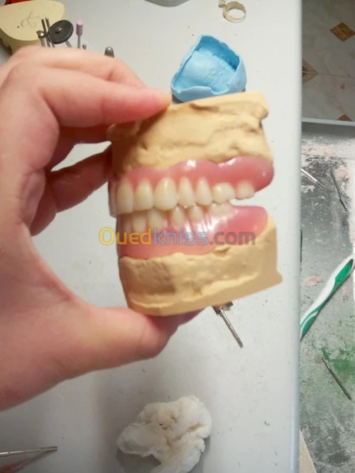 Fabrication de prothèses  dentaire