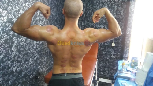 (Cupping thérapie)الحجامة و التدليك