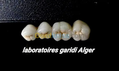Prothèse dentaire de luxe 