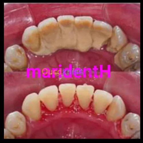 Dentiste Hraoua Soins dentaires,implants, ouvert 7/7