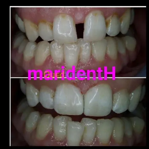 Dentiste Hraoua Soins dentaires,implants, ouvert 7/7