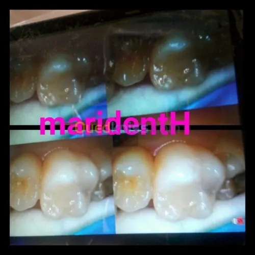 Dentiste Hraoua Soins dentaires,implants, ouvert 7/7