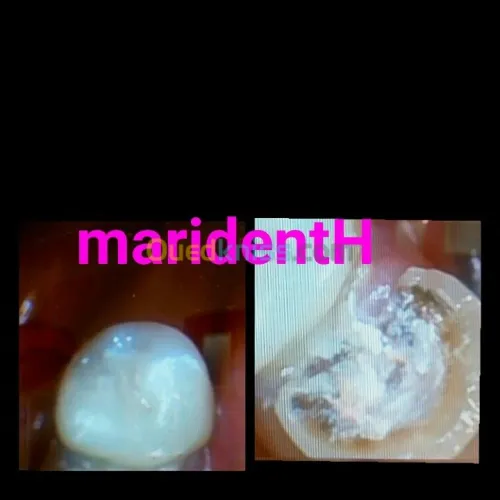 Dentiste Hraoua Soins dentaires,implants, ouvert 7/7