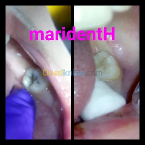 Dentiste Hraoua Soins dentaires,implants, ouvert 7/7