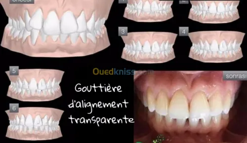 Dentiste Hraoua Soins dentaires,implants, ouvert 7/7