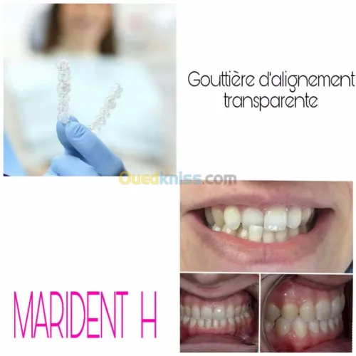 Dentiste Hraoua Soins dentaires,implants, ouvert 7/7