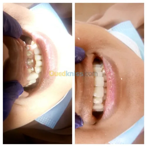 Dentiste Hraoua Soins dentaires,implants, ouvert 7/7