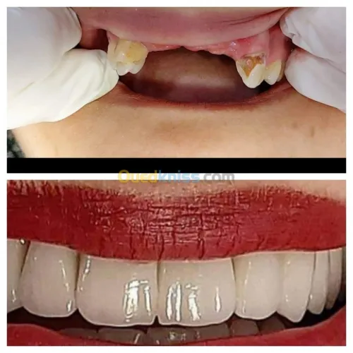 Dentiste Hraoua Soins dentaires,implants, ouvert 7/7