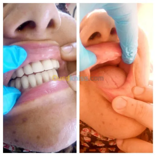 Dentiste Hraoua Soins dentaires,implants, ouvert 7/7