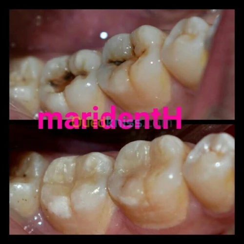 Dentiste Hraoua Soins dentaires,implants, ouvert 7/7