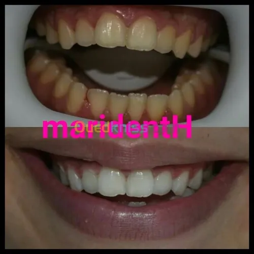 Dentiste Hraoua Soins dentaires,implants, ouvert 7/7