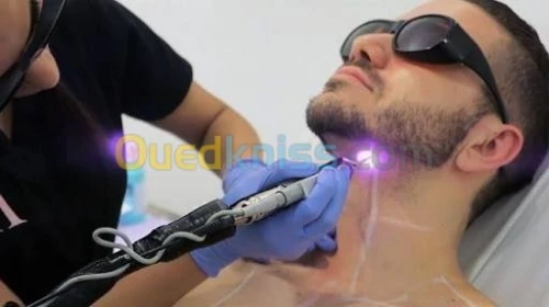 Lasers dermatologique 