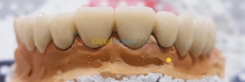 Confection dès prothèse dentaire 