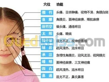 Spécialiste Acupuncture HijamaMédical 