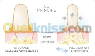 Spécialiste Acupuncture HijamaMédical 