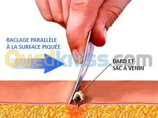 Spécialiste Acupuncture HijamaMédical 