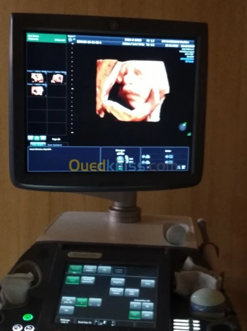 Vente echographie