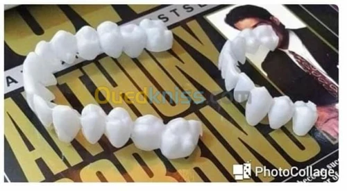 VENEERS