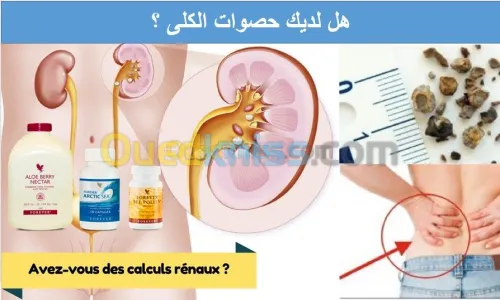 الحصى في الكلى Calculs Rénaux