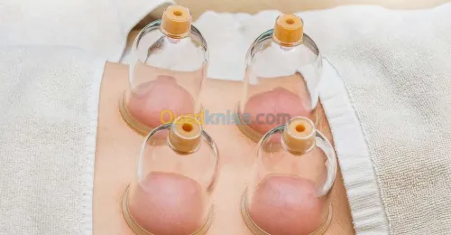 Médecine générale,Mésothérapie,Hijama.