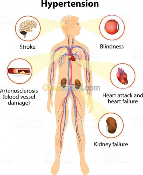 Médecine générale,Mésothérapie,Hijama.