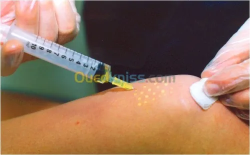 Médecine générale,Mésothérapie,Hijama.