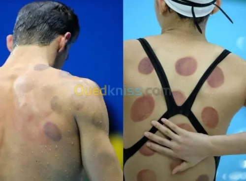 Médecine générale,Mésothérapie,Hijama.