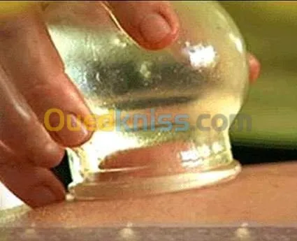 تكوين تطبيقي داخلي