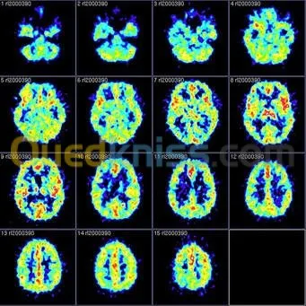 CPHI, Pièces de rechanges médicales