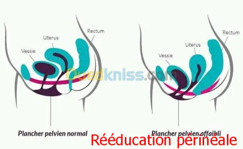 Centre de rééducation Acupuncture 