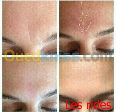 Centre de rééducation Acupuncture 