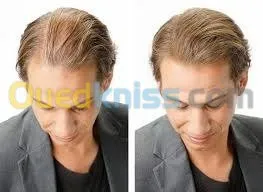 toppik   