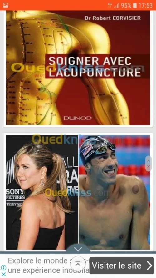 Acupuncture Hernie Discale & Cervical 