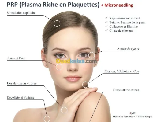 Acupuncture Hernie Discale & Cervical 