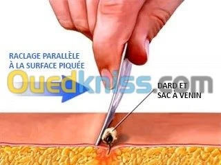 Acupuncture Hernie Discale & Cervical 