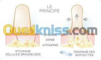 Acupuncture Hernie Discale & Cervical 