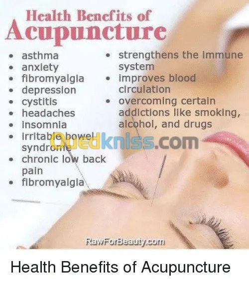 Spécialisé Acupuncture Hijama Médical7