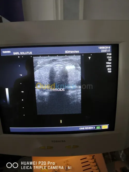 Echographe Toshiba Nemio 