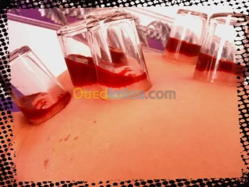 Hijama