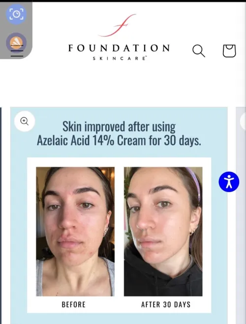 The Ordinary Azelaic Acid Suspension 10%