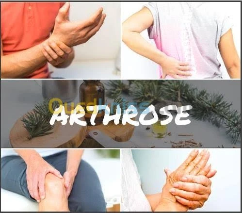 ARTHROSE RHUMATOLOGIE