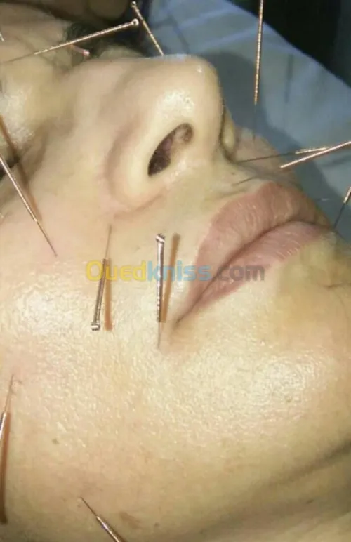 الغلاج الطبيعي