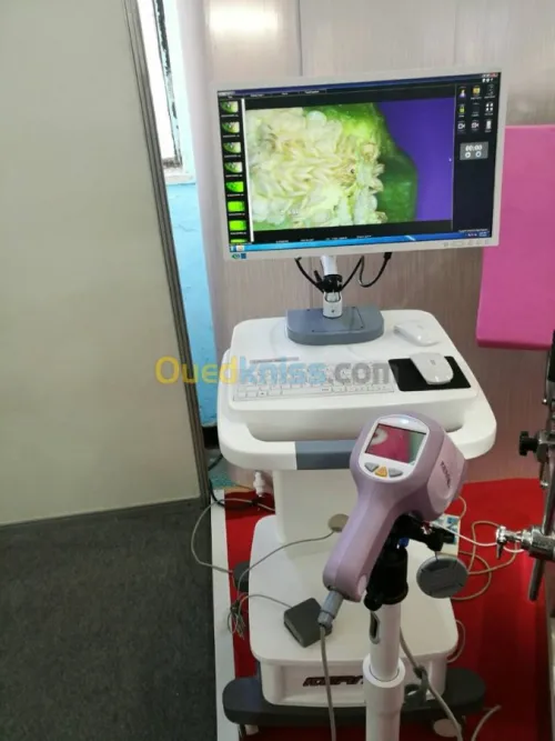 Colposcope numérique