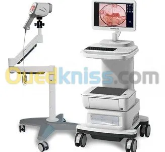 Colposcope numérique