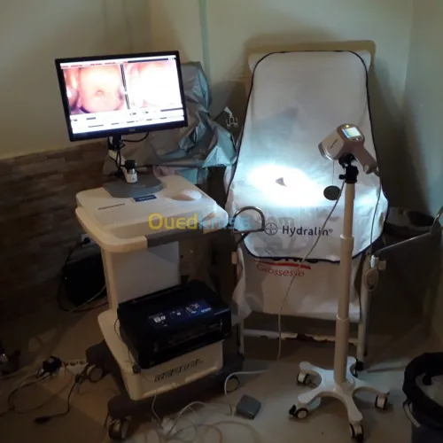 Colposcope numérique