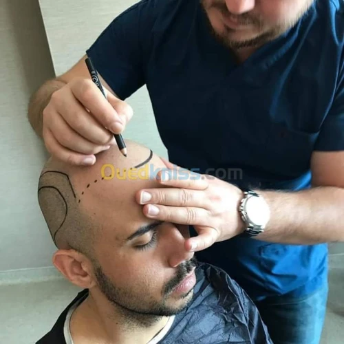 Greffe de Cheveux /زراعة الشعر الجزائر