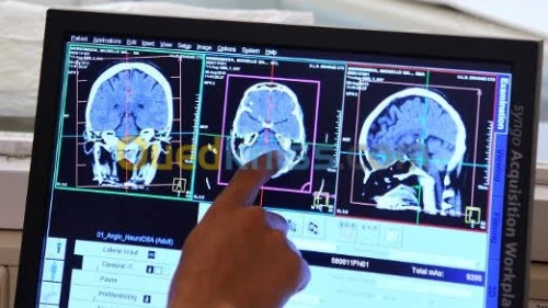 Consultation spécialisé