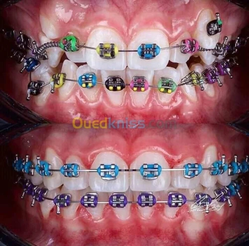 formation prothése dentaire