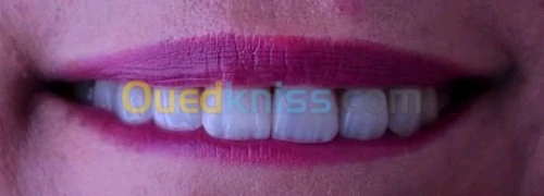 Prothesiste/مركب اسنان